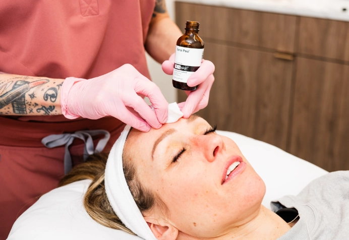 Chemical Peels in Westfield, Carmel & Zionsville, IN | Como