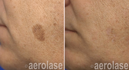 a close-up of a person's face