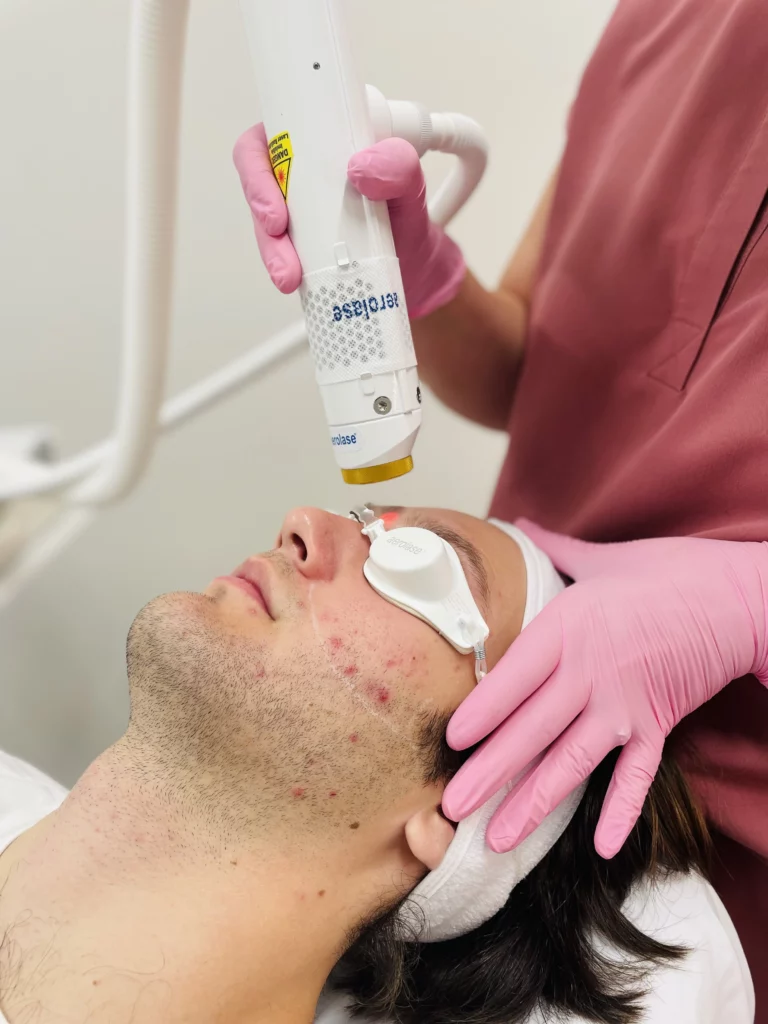 Aerolase Neo Elite Laser Treatment in Westfield, IN | Como