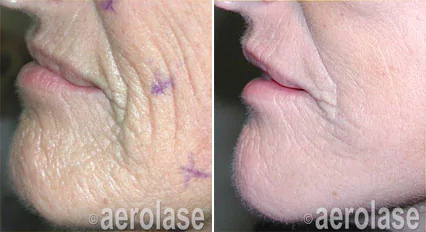 close-up of a person's face and neck