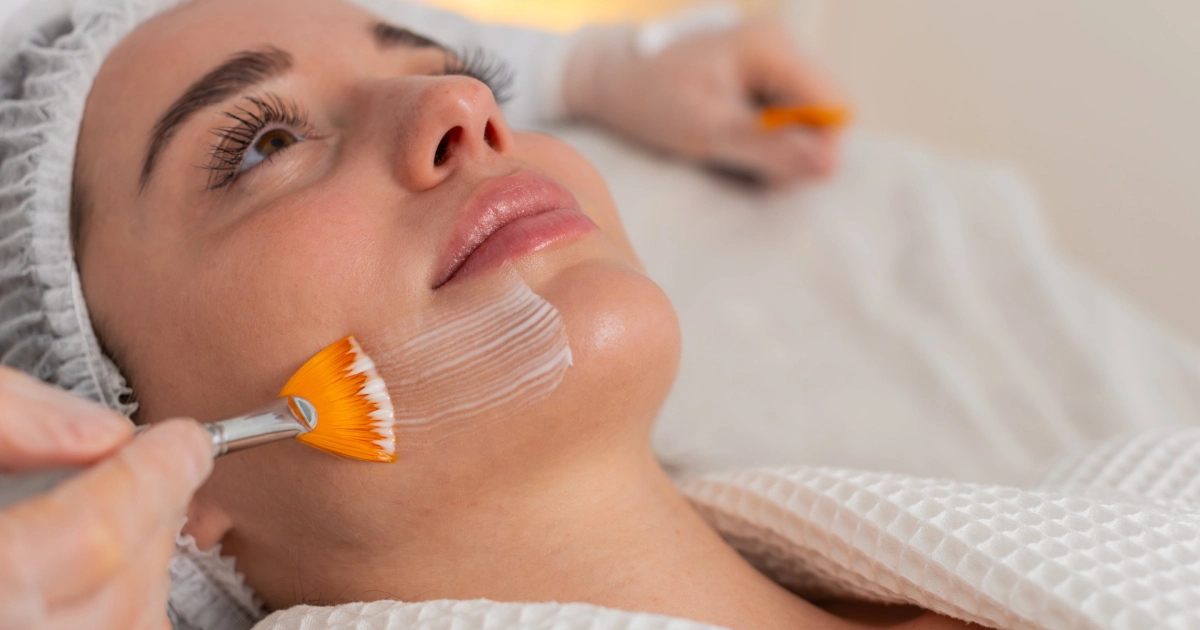 A woman lies on a spa bed while a professional applies a chemical peel solution to her cheek using a brush during a facial treatment in Westfield, IN