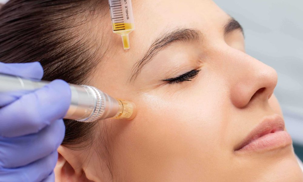 Microneedling treatment | COMO Aesthetics in Westfield, IN